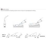 Końcówka ultradźwiękowa Woodpecker GD5 kompatybilna z Satelec, Profi - obrazek 2