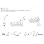 Końcówka ultradźwiękowa Woodpecker GD6 kompatybilna z Satelec, Profi - obrazek 2