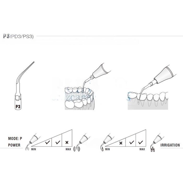 Ponta ultrassónica Woodpecker PD3 compatível com Satelec, Perio - Image 2