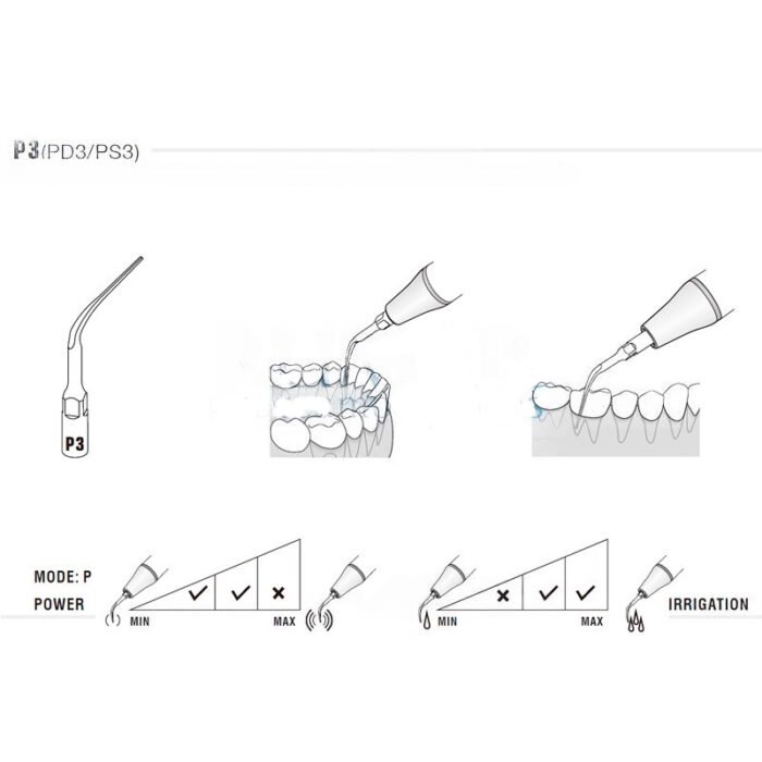 Woodpecker PD3T Ultraschallspitze kompatibel mit Satelec, Perio, TITANIUM – Bild 2