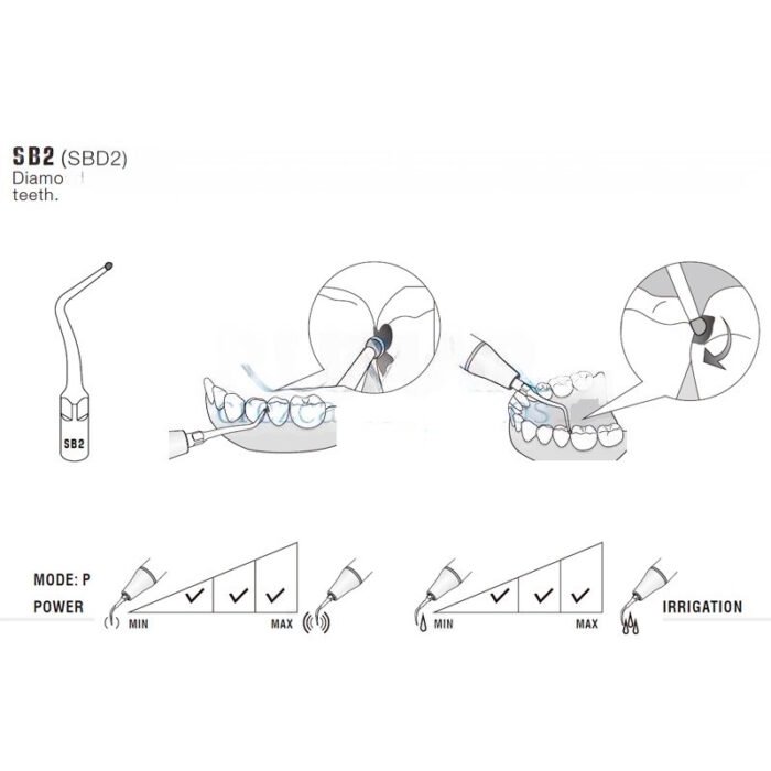 Końcówka ultradźwiękowa Woodpecker SBD2 kompatybilna z Satelec, Cavities, DIAMOND - obrazek 2