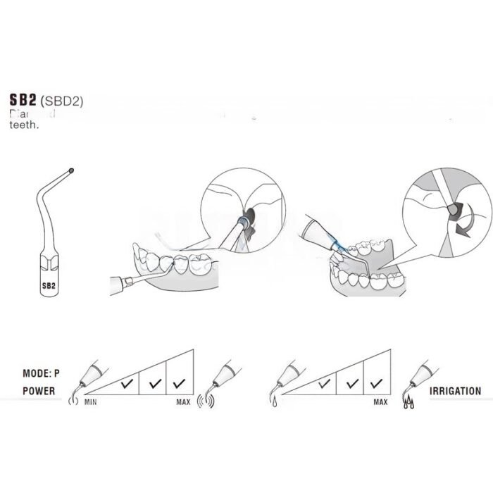 punta-woodpecker-dte-ems-28-sb2-marca-2 Kompatybilna z końcówką ultradźwiękową Woodpecker SB2 EMS, Ubytki, DIAMENT - obrazek 3