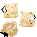 Bader BADER® DENTAL® Chirurgisches Tipodontal® Chirurgisches Tipodont – Bild 5