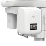 Ceph Stellaris 3D z implantem - obrazek 3