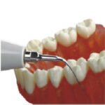 SATELEC G5 EDELSTAHL-TITAN-ULTRASCHALLSPITZENEINSATZ – Bild 4