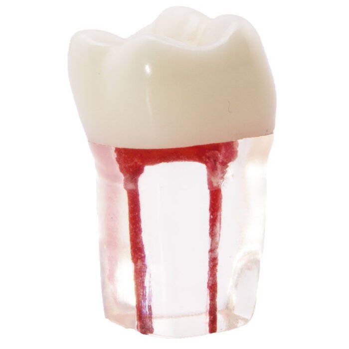 Molar com canais radiculares de Bader - Image 1