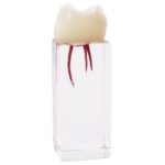 Molar Endodôntico BADER® DENTAL®
