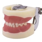 Typodoncja dla dzieci Nissin® typu BADER® DENTAL® - obrazek 4