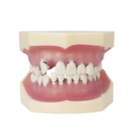 Model periodontologiczny BADER® DENTAL®