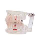 Modelo dentário transparente com implante BADER® DENTAL® - Image 2