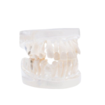 BADER® DENTAL® kieferorthopädisches Zahnmodell für die kieferorthopädische Praxis – Bild 2