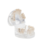 BADER® DENTAL® kieferorthopädisches Zahnmodell für die kieferorthopädische Praxis – Bild 3