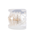 BADER® DENTAL® kieferorthopädisches Zahnmodell für die kieferorthopädische Praxis – Bild 4
