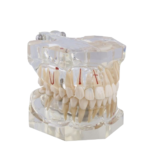 Macromodelo Bader®Dental® com patologia completa