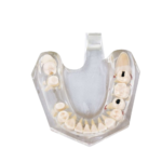 Macromodelo Bader®Dental® com patologia completa - Image 2