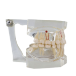 Macromodelo Bader®Dental® com patologia completa - Image 3
