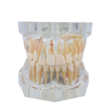 Macromodelo Bader®Dental® com patologia completa - Image 4