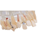 Macromodelo Bader®Dental® com patologia completa - Image 5