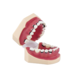 BADER® DENTAL Vollständiges Parodontologie-Modell – Bild 2