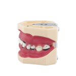 BADER® DENTAL Vollständiges Parodontologie-Modell – Bild 4